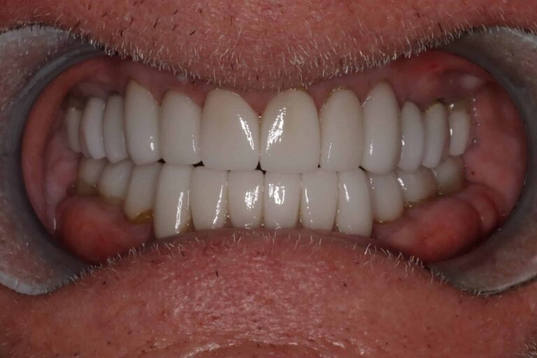Konig Center for Cosmetic & Comprehensive Dentistry smile photos